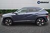 Hyundai KONA 1.0T 115 Ultimate 5dr Blue